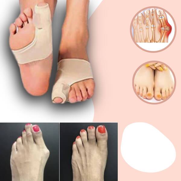 Dream Bunion Corrector™