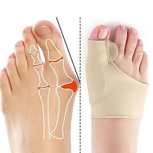 Dream Bunion Corrector™